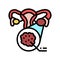 polycystic ovary syndrome endocrinology color icon vector illustration