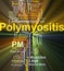 Polymyositis PM background concept glowing