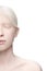 Portrait of beautiful albino woman isolated on white studio background. Beauty, fashion, skincare, cosmetics concept.