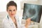 Portrait of doctor woman pointing on fluorography