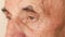 Portrait of an elderly Caucasian male over 70 who blinks frequently. Desperate and tired look of an elderly person. Close-up of th