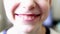 Portrait of handsome boy mouth smiling and laughing with glad expression on face and white teeth. child smile close.