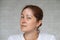 Portrait of a smiling woman with a pigmented spot on her forehead. Girl with Vitiligo Disease.