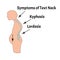 The position of the spine with lordosis, kyphosis. Text Neck Syndrome. Spinal curvature, kyphosis, lordosis, scoliosis