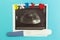 A positive pregnancy test with two strips, an ultrasound photograph and the word `baby` on a blue background