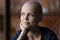 Positive thoughtful young hairless woman with cancer portrait