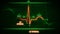 PR and QT Intervals of Electrocardiogram Wave or ECG or EKG