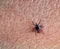 A predatory tick crawls along the human body