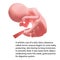 Pregnant. Human fetus inside the womb. Fetus stages. .