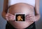 Pregnant mother 3D baby echo