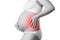 Pregnant woman with back pain, risk of premature birth