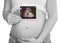 Pregnant Woman Holding Baby Sonogram