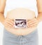Pregnant woman holding the digital echography photograph of her