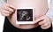 Pregnant woman holding ultrasound photo