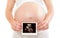 Pregnant woman holding ultrasound picture
