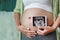 Pregnant woman show ultrasound film while standing at house