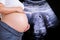 Pregnant Woman with ultrasound equipment background