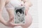 Pregnant woman in underwear holding and showing digital tablet with fetal ultrasound photo on white wooden background. Close-up