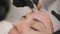 Preparing to microneedle procedure, a facial rejuvenation procedure for a woman. Closeup