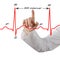 Presenting marked ECG