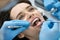 Pretty woman`s teeth treatment in dental clinic