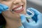 Pretty woman`s teeth treatment in dental clinic
