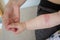 Prickly heat. Close-up of the folds of the hand of a newborn baby with red skin.