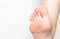 Problem skin with calluses and corns on the sole of the human foot, dry and rough skin, inflammation and pain, foot, close-up