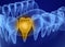 Problem teeth xray view. Medically accurate tooth illustration