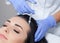 Procedure of mesotherapy. The doctor cosmetologist makes the procedure of mesotherapy in woman`s head.