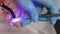Professional chiropodist installs a titanium thread on the big toe. Correction of ingrown toenail. Closeup, top view