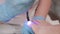 Professional chiropodist installs a titanium thread on the big toe and using UV gadget. Correction of ingrown toenail