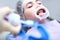 Professional teeth cleaning. Caries prevention. A young girl at the dentist`s appointment. Retractor in the mouth.