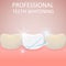 Professional Teeth Whitening, Healthy Tooth and yellow teeth,