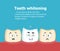 Professional teeth whitening vector illustration