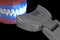 Proffesioinal teeth whitening, light-activation on tooth bleaching. 3D illustration concept