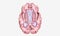 Progression of Multiple Sclerosis Transverse View