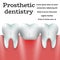 Prosthetic dentistry 1