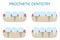 Prosthetic dentistry poster. icons of different variants of implant prosthetics.