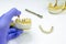 prosthetics on dental implants. concept of orthopedic dentistry. ceramic bridge on implants