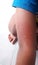 Pruritus, skin rash in children, allergy