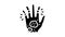 psoriatic arthritis skin health problem glyph icon animation