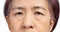 The ptosis or droopy eyelids in asian senior woman