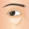 Puffy eye bag close up of aging woman\\\'s face, illustration