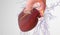 The Pulmonary Artery Catheter (PAC
