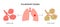 Pulmonary edema disease