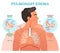 Pulmonary edema, lung problem vector illustration diagram