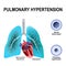 Pulmonary hypertension