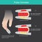 Pulse Oximeter. Illustration