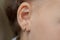 The puncture of ears to children is younger than three years